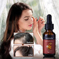 Organic Hair Growth Oil Rosemary Ginseng Peppermint Anti-Hair Loss Scalp Nourishment for Men/Women Baldness Prevention 30ml