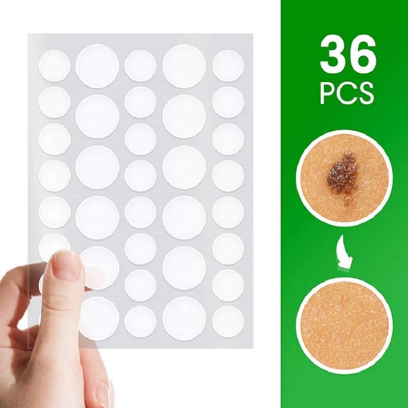 Beauty Cosmetics Skin Care Private Label Acne Spot Facial Stickers Hydrocolloid Tea Tree Calendula Oil
