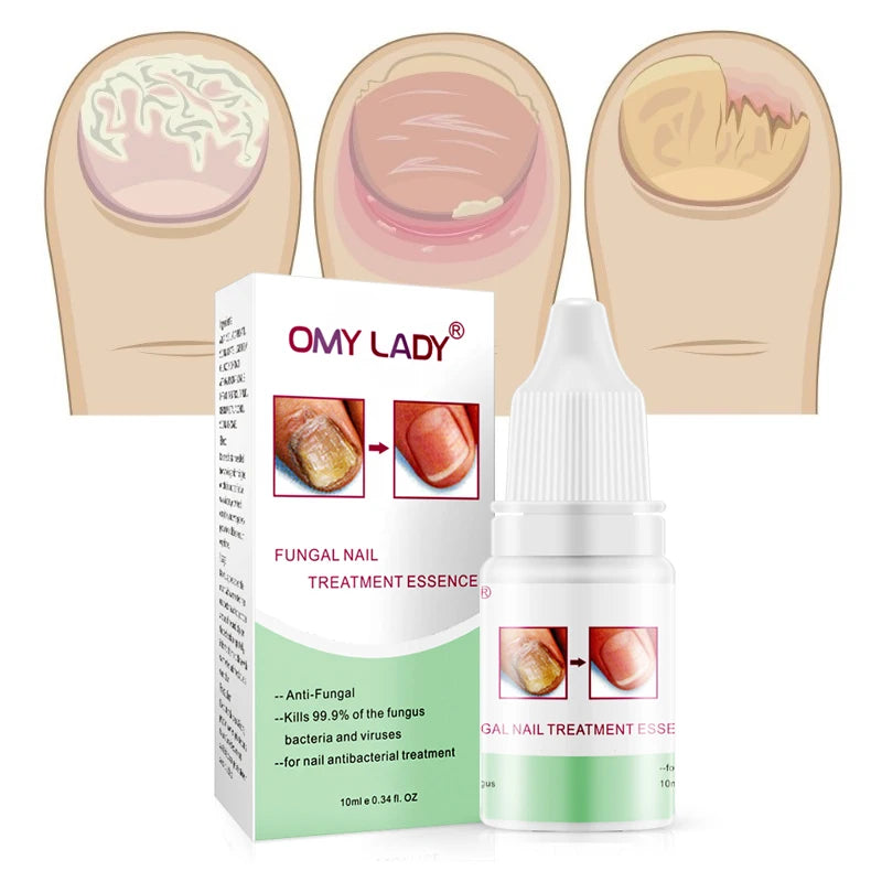 10ml New Herbal Care Multi-Purpose Nail Repair Serum Anti Fungal Damaged Toenail Fungus Treatment