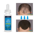60ml Hot Sell Anti Hair Loss Treatment Hair Growth Oil Biotin Hair Care Serum