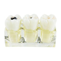 4 Times Removable Pathological Dental Model Caries Tooth Anatomy Education Teeth Model Decomposition Multi-Purpose Oral Hygiene