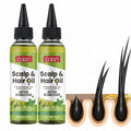 Private Label Hair Repair Promote Growth Scalp Anti-itch Hair Scalp Oil