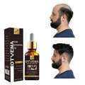 OTVENA Top Selling Strong Healthy Hair Treatment Scalp OEM/ODM Regrowth Oil Hair Care for Men Hair Growth Oil Serum MegaBDM