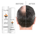 Omy Lady Hair Growth Oil  Sample Bulk Lotion Growth Hair Spay for Anti Hair Loss