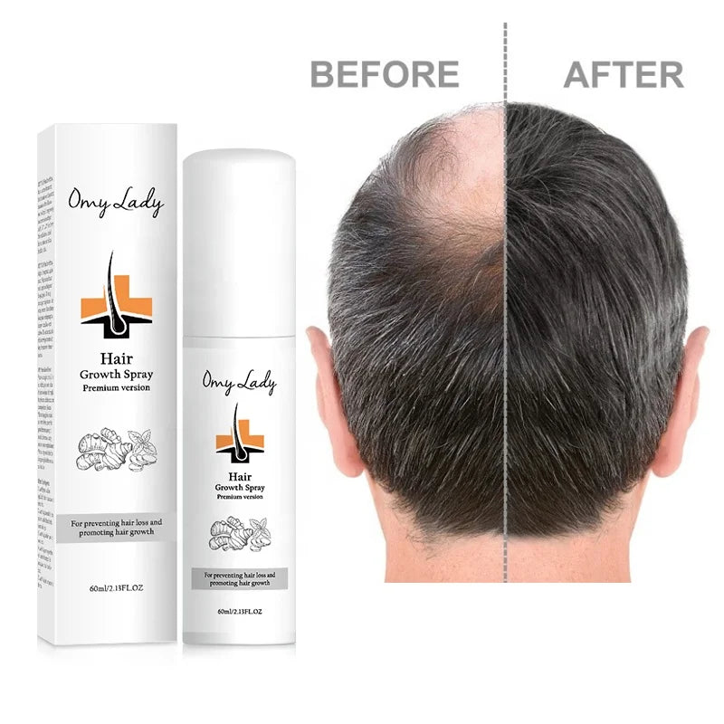 Omy Lady Hair Growth Oil  Sample Bulk Lotion Growth Hair Spay for Anti Hair Loss