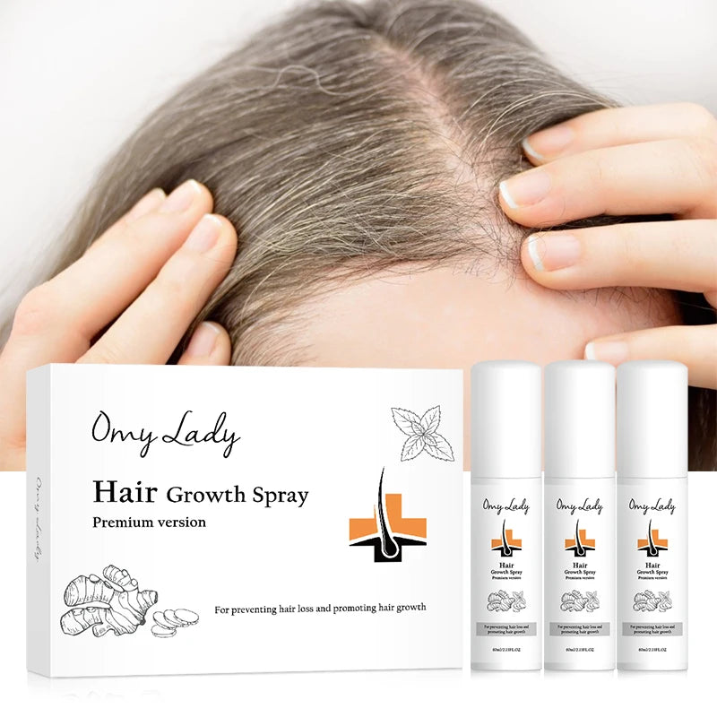Sample Omy Lady Personalized Packaging Mild Formula Strong Effect Anti Hair Loss Spray Essence Hair Growth Product