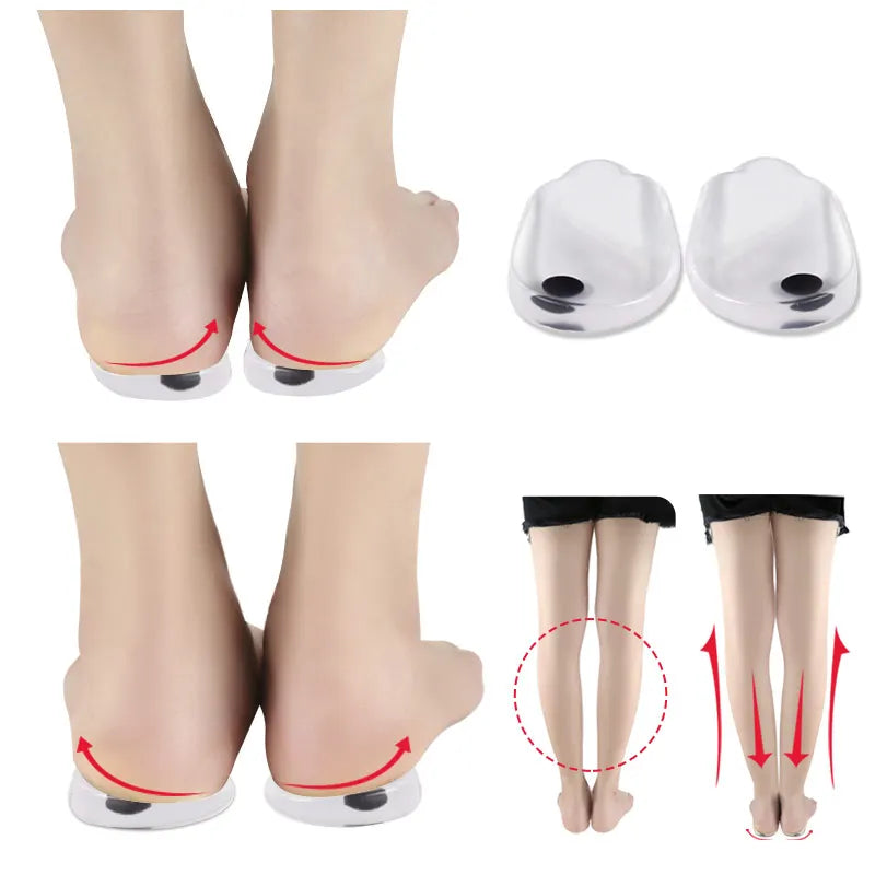 Sports Comfort Orthopedic Gel Insoles Adhesive Pads for Bow Legs Lateral Heel X Leg Insert Shoe Inserts Cushion for Sports