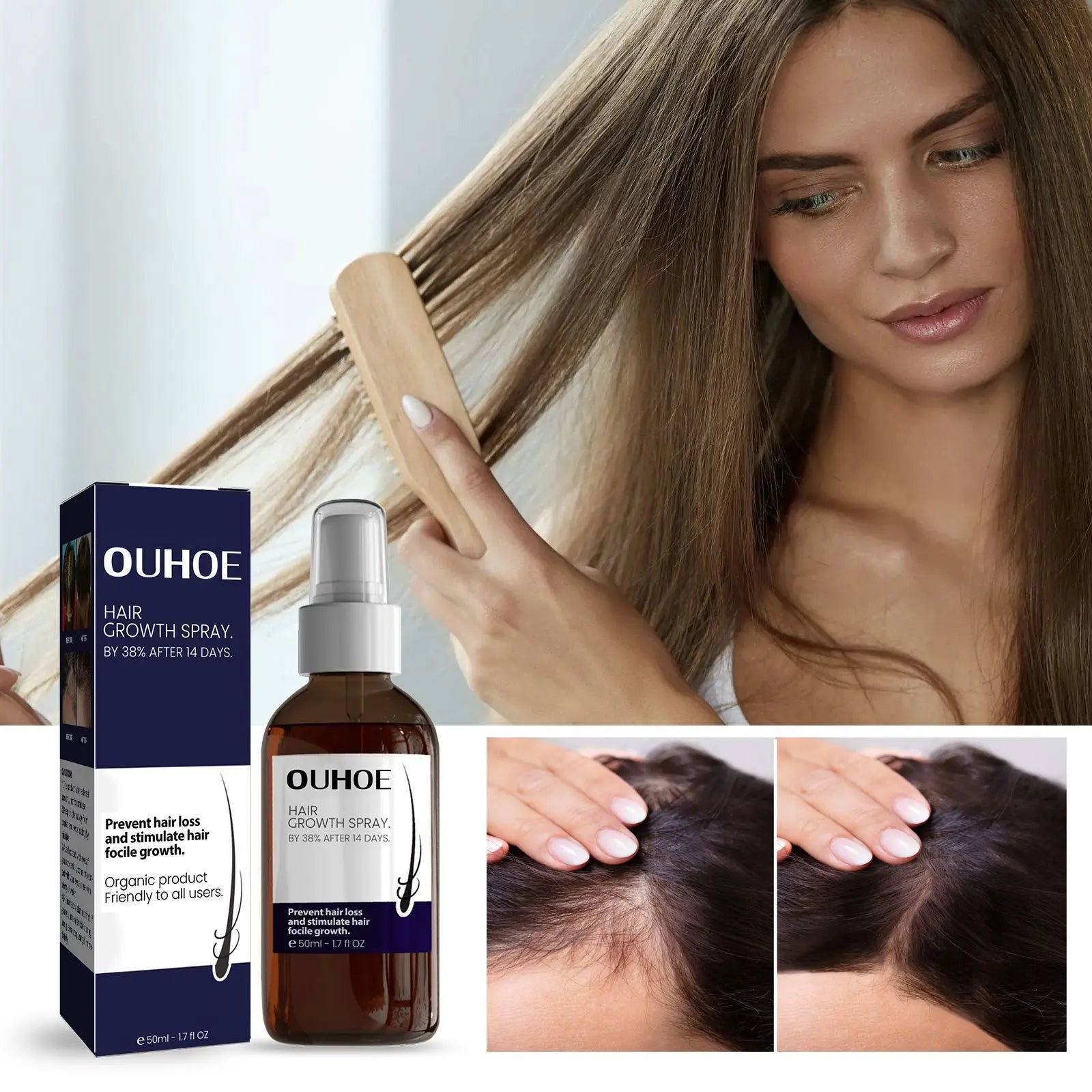 Repair Stop Hair Root Growth Hair Loss Treatment Spray Regrowth Nutrient Solution Repair Serum Hair Growth Spray
