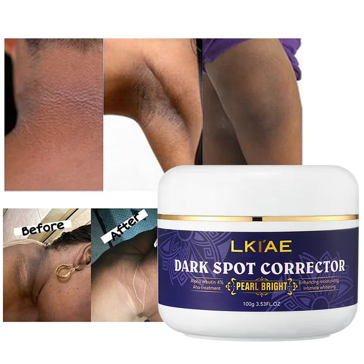 Top Seller Glutathio Knuckles Underarm Knees Moisturizing Whitening Glowing Skin Face Cream