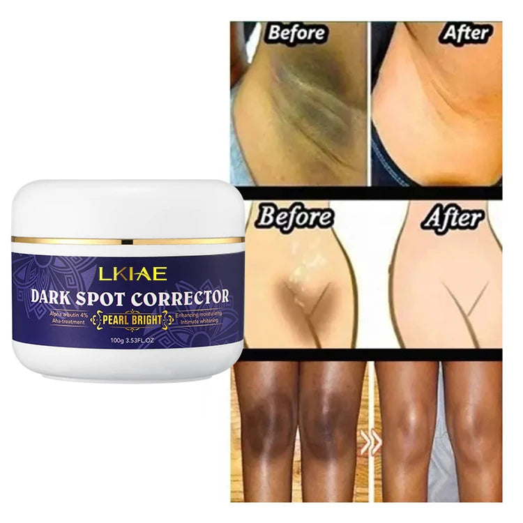 Private Label Vitamin C Whitening Face Cream Niacinamide Alpha Arbutin Brightening Moisturizer Even Skin Tone Custom Logo