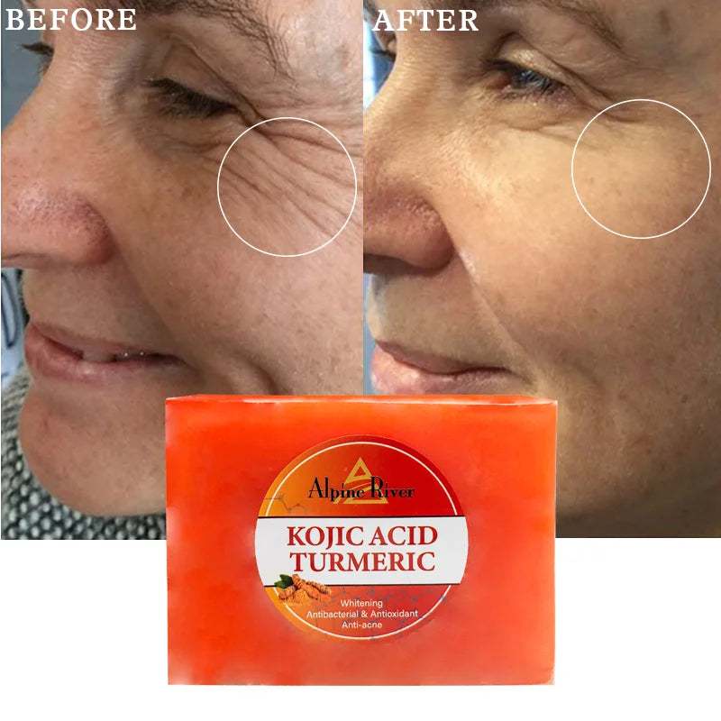 200g Natural Organic Honey Turmeric Skin Whitening and Exfoliating Kojic Acid Soap Anti-Wrinkle Whitening Soap