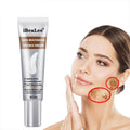Pimples Melasma Blemish Removal Dark Spot Remover Cream Strong Bleaching Whitening Face Freckles Remove Corrector Cream