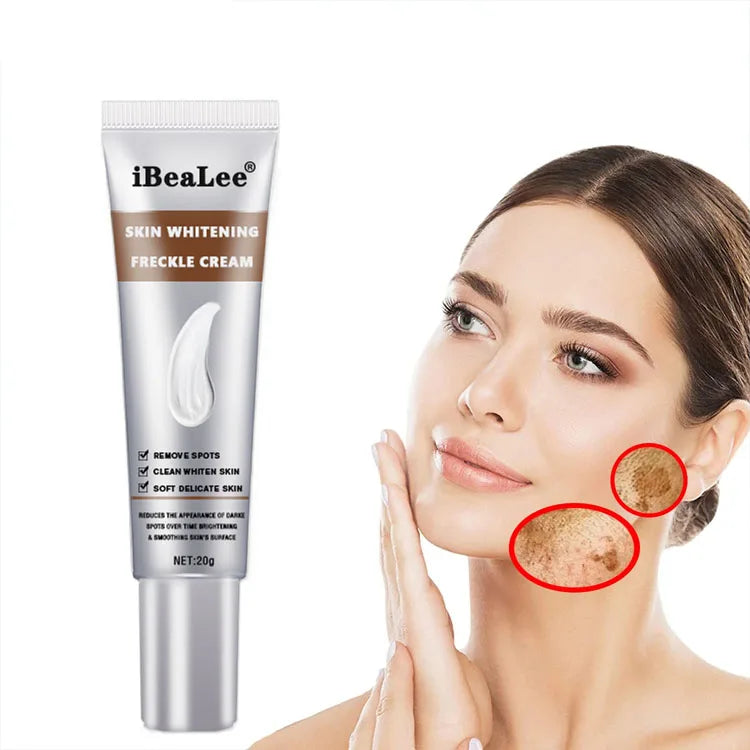 Pimples Melasma Blemish Removal Dark Spot Remover Cream Strong Bleaching Whitening Face Freckles Remove Corrector Cream