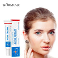 KORMESIC Nourishing and Formula Skin Lotion Face Acne Scar Pimples Dark Spot Remover Anti Acne