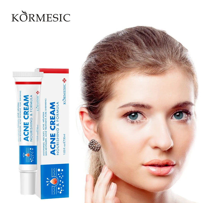 KORMESIC Nourishing and Formula Skin Lotion Face Acne Scar Pimples Dark Spot Remover Anti Acne