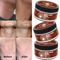 Luxfume Private Label Reduce Razor Bumps Men Care After Shaving Cream Soothing Post Shave Balm for Ingrown Hairs Redness Relief