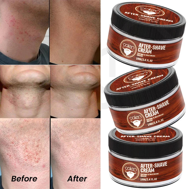 Luxfume Private Label Reduce Razor Bumps Men Care After Shaving Cream Soothing Post Shave Balm for Ingrown Hairs Redness Relief