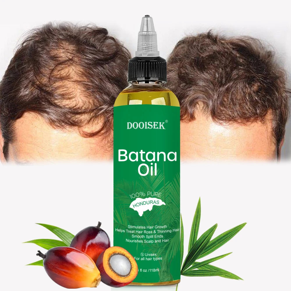 New Factory Anti Hair Loss Treatment DHT Blocker Capsules Biotin Saw Palmetto Vegen Batana Oil for Hair Growth Restoration