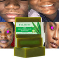 Aloe Vera & Olive Oil Anti-Acne Whitening Bar Soap for Face Body & Shaving-Gentle Moisturizing Formula