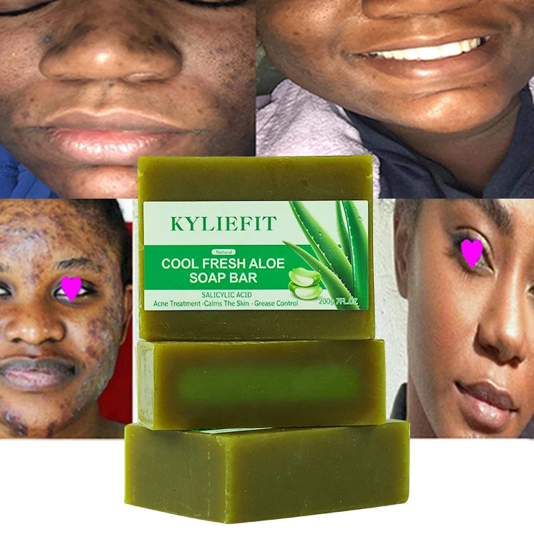 Aloe Vera & Olive Oil Anti-Acne Whitening Bar Soap for Face Body & Shaving-Gentle Moisturizing Formula