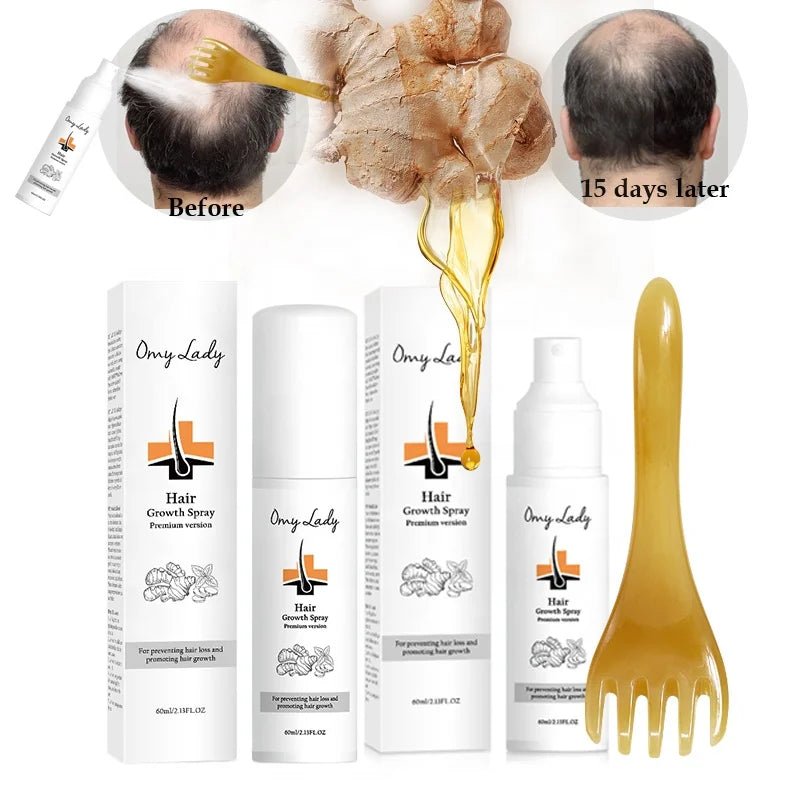 Dropshipping Sample Hair Loss Treatment Machine Natural Hair Growth Oil Private Label Hair Growth Spray