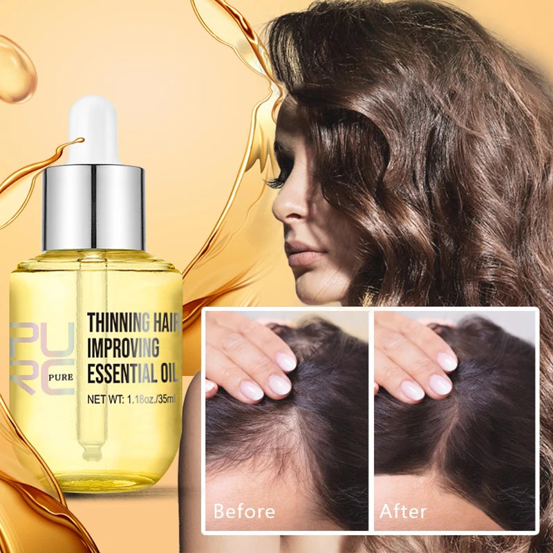 Factory Natural PURC Hair Density Essential Oil Organic Hair Growth Oil Private Label Hair Regrowth Ginger Oil Serum