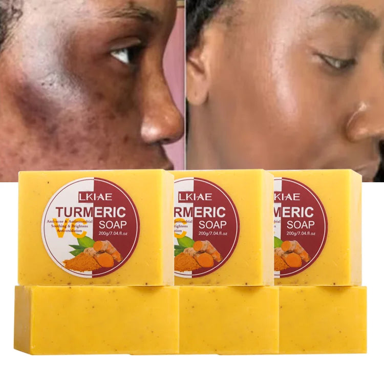 Factory 100 % Natural Organic CoffeeVitamin CHoneyAloe VeraCarrotGoat MilkTumericKojic Acid Whitening Handmade Soap