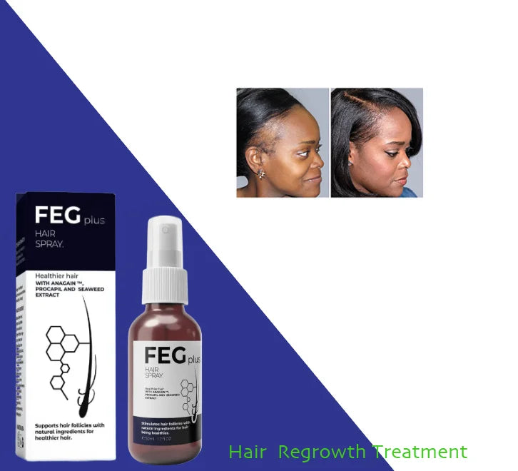 For PLUS Effective Original Hair Spray Natural Argan Oil 100% Natural Herbal Formula for Chinese Hair Regrowth 60ml X3 Bottles MegaBDM