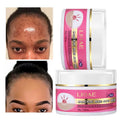 Salicylic Acid Vegan Soothing Anti-Acne Pimple & Scar Removal Moisturizing Skin Brightening Night Face Cream