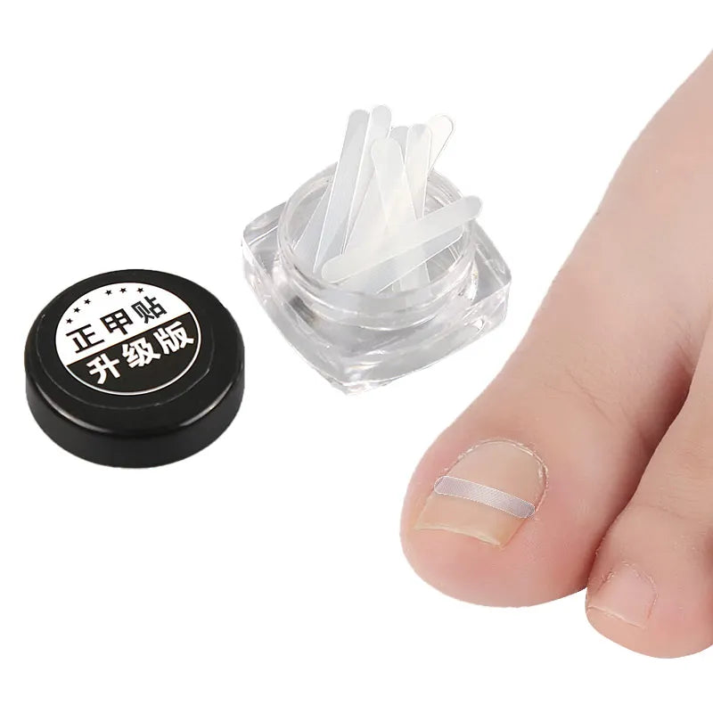 10 Pieces Foot Curve Fit Transparent Straightening Elastic Adhesive Ingrown Toenail Corrector Strips Paronychia Correction Tool