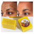 Private Label Wholesale 100% Organic Handmade Bar Soap Turmeric Anti-Acne & Lightening Solid Whitening Antiseptic for Bath Face