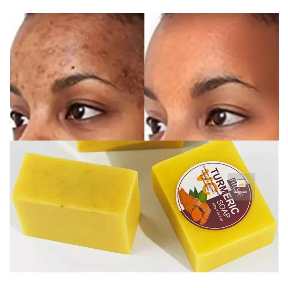 Private Label Wholesale 100% Organic Handmade Bar Soap Turmeric Anti-Acne & Lightening Solid Whitening Antiseptic for Bath Face
