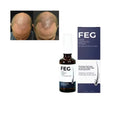 For Anti-Hair Loss Hair Spray Natural Argan Oil-100% Natural Herbal Formula 60ml*3 Bottles for Improved Growth Smoother