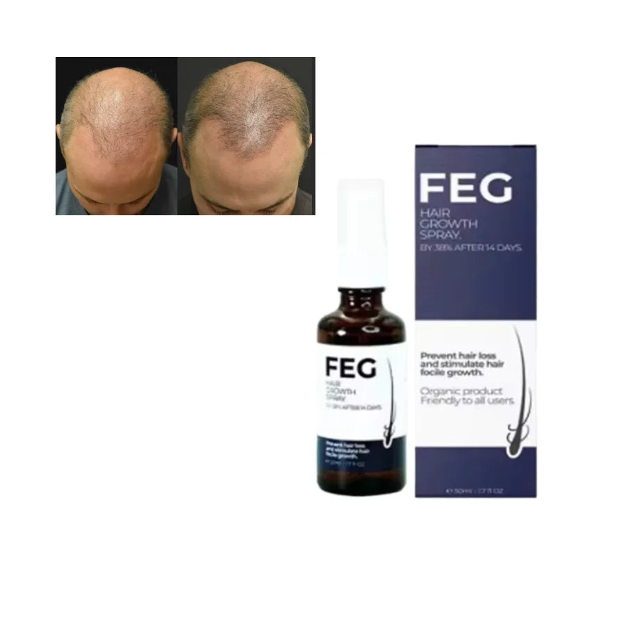 For Anti-Hair Loss Hair Spray Natural Argan Oil-100% Natural Herbal Formula 60ml*3 Bottles for Improved Growth Smoother
