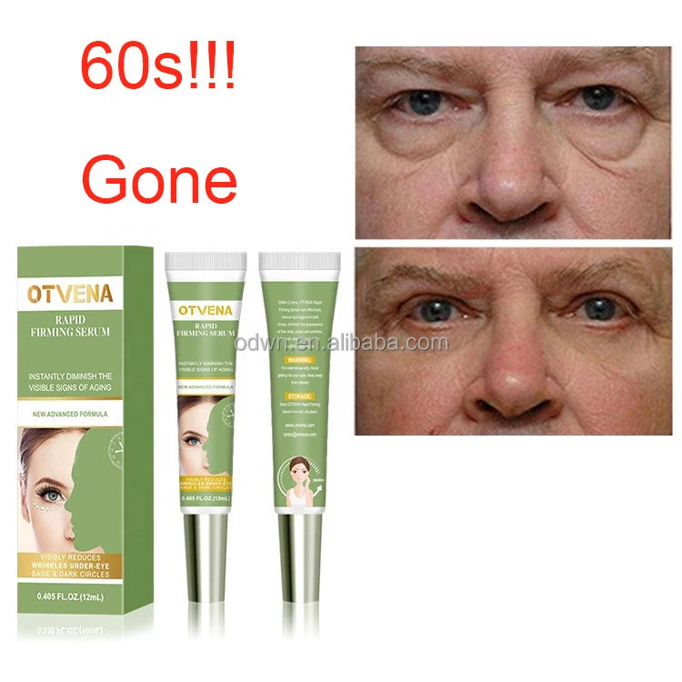 Korea Eyes Filler Repair Firming Anti Aging Set Private Label Natural Cream