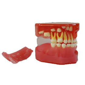 3-Year-Old Clear Mixed Dentition Teeth Model for Medical Science