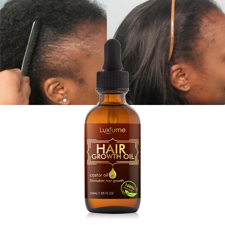 Private Label Natural Organic Biotin Hair Growth Oil Serum for Men and Women Anti Hairloss