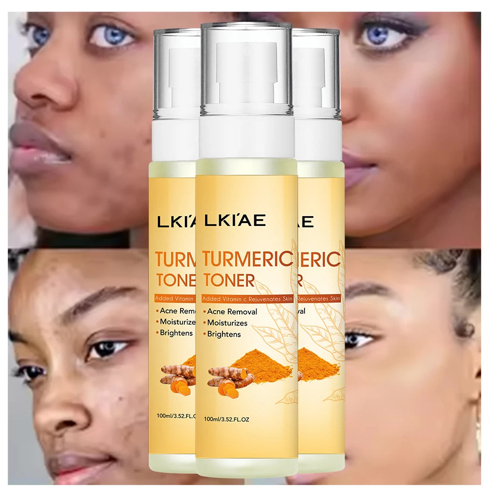 Natural Organic Vegan Turmeric Whitening Vitamin C Brightening Facial Skin Care Moisturizing Spray Toner for Oily Skin