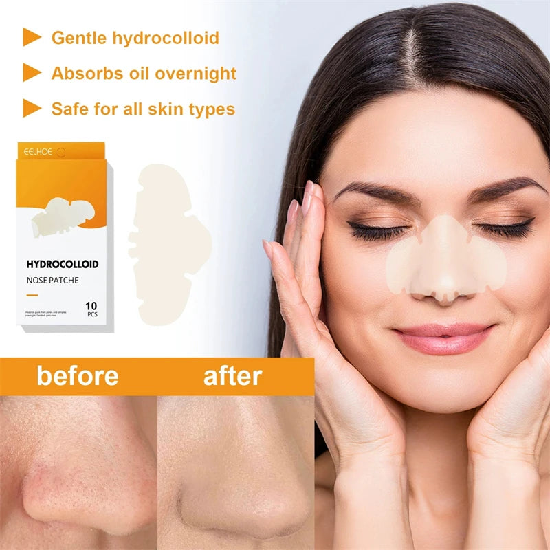 EELHOE 10pcs Hydrocolloid Nose Patches Cleaning Peeling off Nasal Mask Blackhead Removing Patch