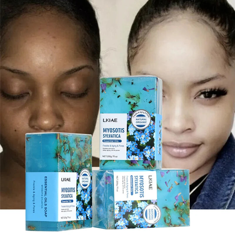 LKIAE Controls Oily Soaps Coconut Oil Pimple Anti-Aging Whitening Brightening Face Acne Handmade Vegan Soap for Pimples