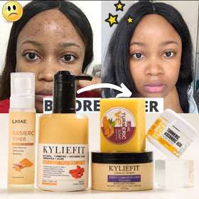 Private Label Face Beauty Hydrating Turmeric Carnosine Vitamin C Rejuvenating Brightening Anti Acne Skin Care Set (New)