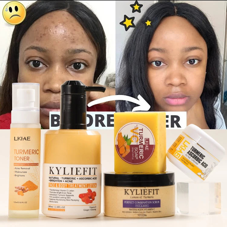 Private Label Face Beauty Hydrating Turmeric Carnosine Vitamin C Rejuvenating Brightening Anti Acne  Skin Care Set (New)