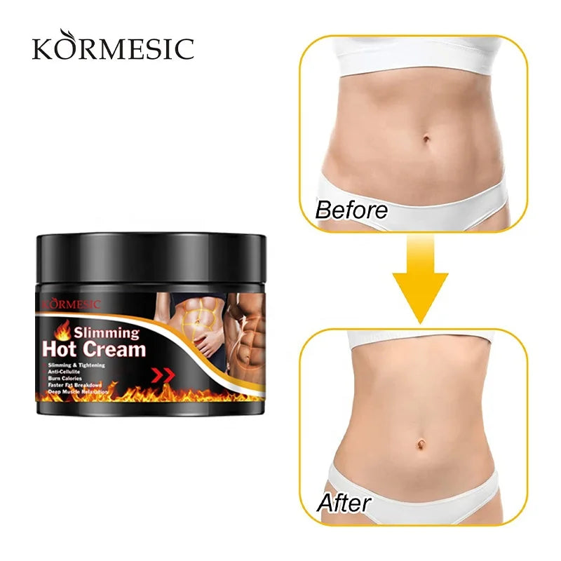 KORMESIC  Fat Burning Slimming Gel Private Label OEM ODM  Weight Los Body Cellulite Arm Slimming Cream Fat Burning Cream