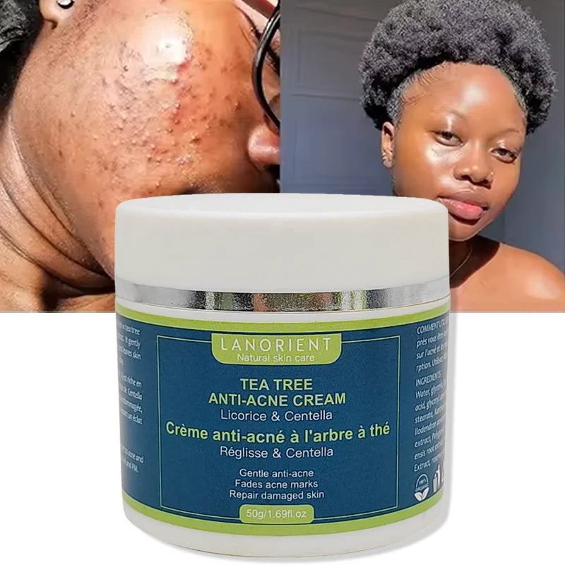 Private Label Best Face Cream for Fair Skin Whiting Cream for Face and Body