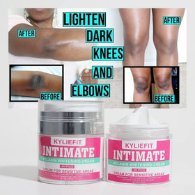 OEM ODM 7 Days Organic Vegan 50ml Dark Knees & Elbows Whitening Cream with Kojic Acid & Collagen