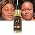 For AILKE 24K Gold Piptide Melanin Serum Anti-Aging & Acne-Fighting Vitamin Collagen Facial Care Whitening and Brightening Skin