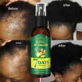 Herbicos 30ML Hair Loss Treatment Serum Germinal Essential Oil Ginger Hair Growth Oil