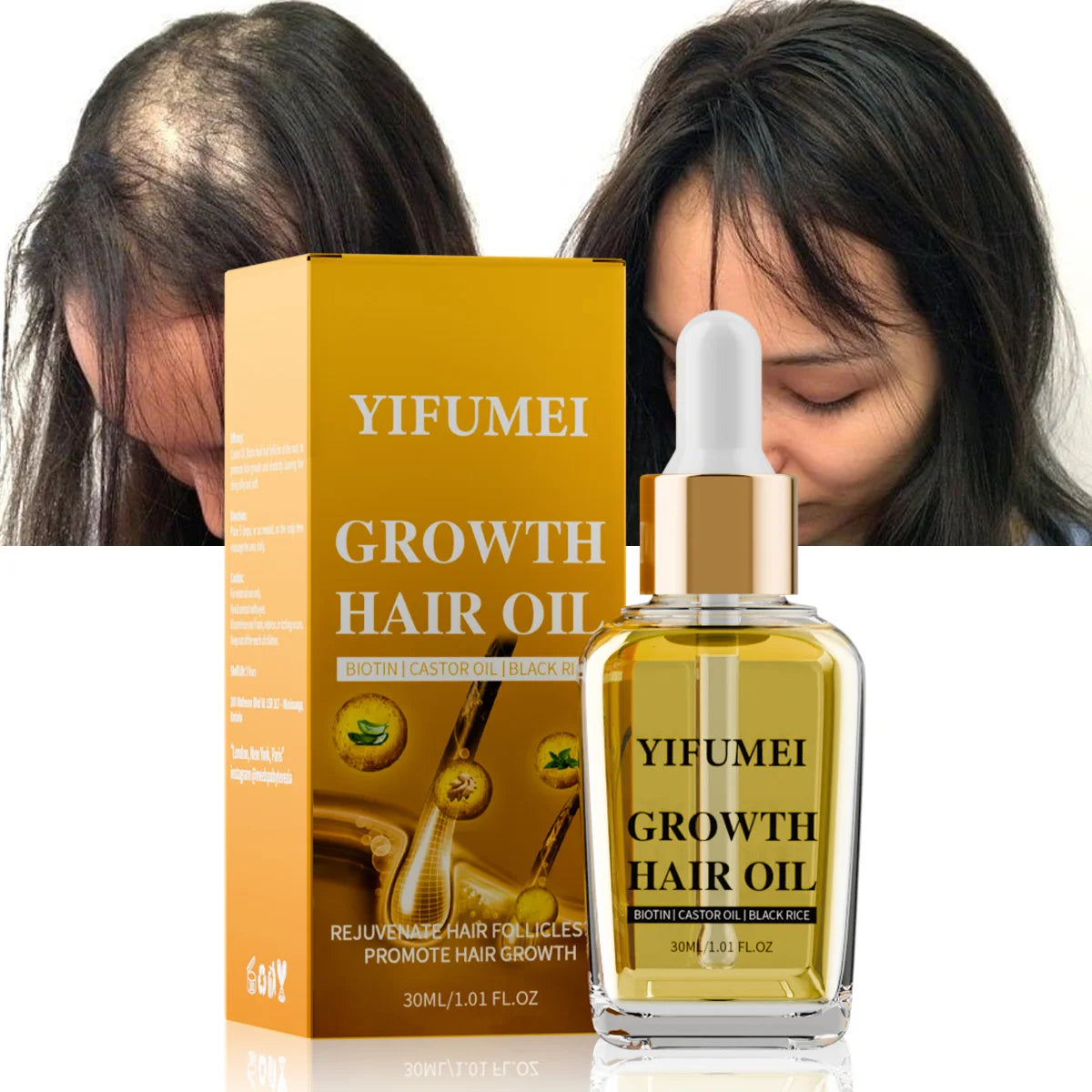 Private Label Natural 100% Ginger Caffeine Tonic Hair Care Essential Oil Biotin Strengthening Scalp Hair Growth Serum Oil