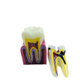 Manual Dental Teaching Equipment for Caries Detection Oral Therapy Accessories 6 Times Contrast Model for Teaching Oral Tooth