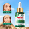 Wholesale Face Whitening Lightening Acne Dark Patches Anti-aging Bright Skin Acne Dark Spot Corrector Skin Care Serum Oil